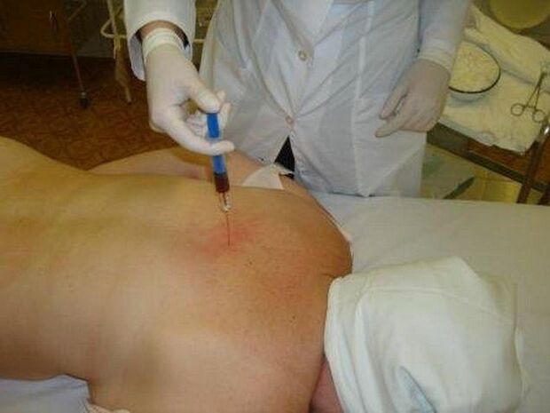 Përgatitjet për osteokondrozën