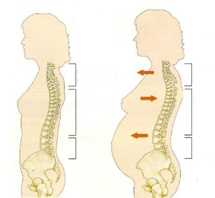 osteokondroza gjatë shtatzënisë